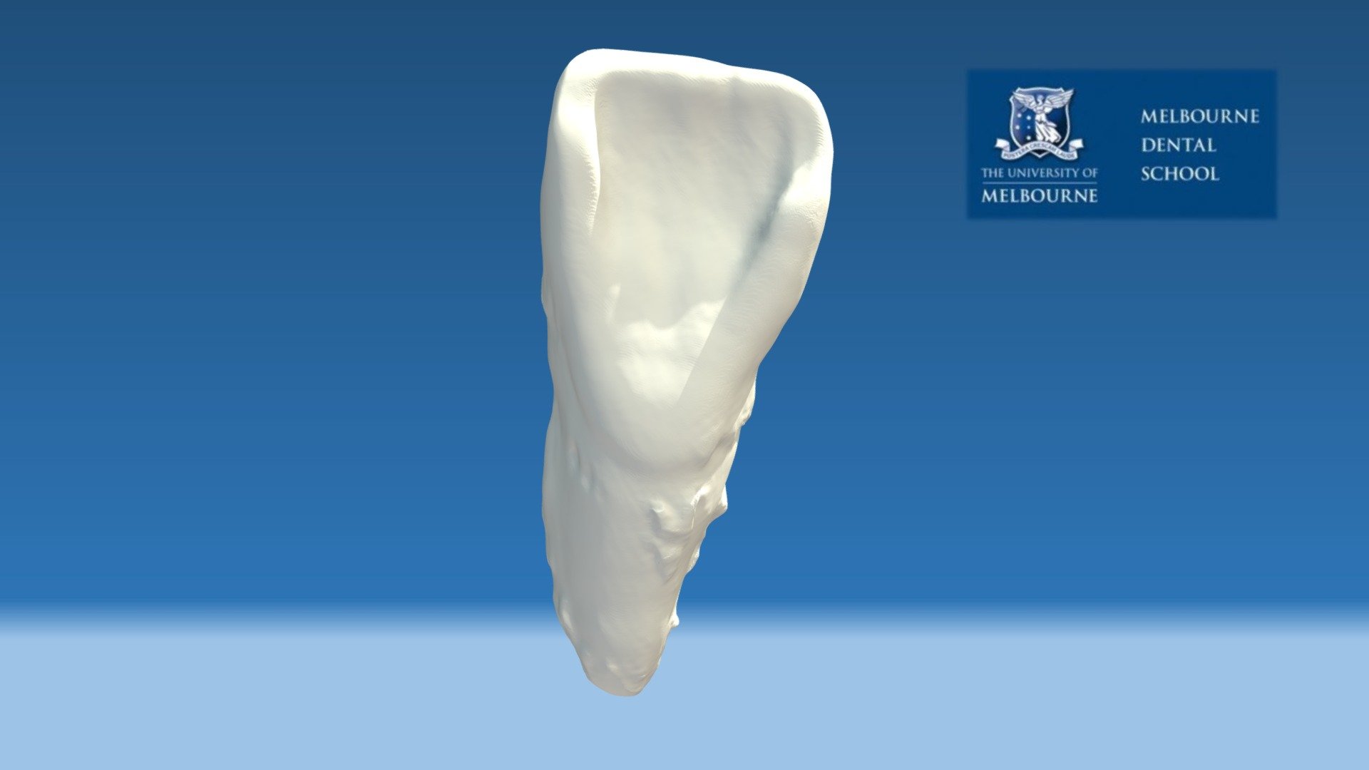 shovel-incisor-3d-model-by-melbourne-dental-school-ritasodontology