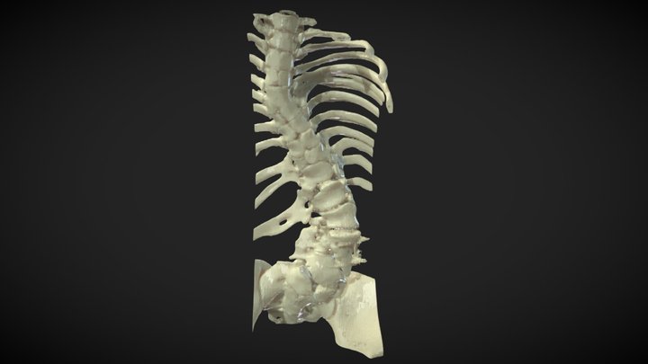 Radiology 3D models - Sketchfab