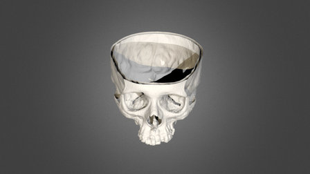 Normal Skull v0.1 3D Model