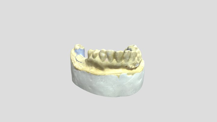 Partial Denture Lower Cast Scan 3D Model