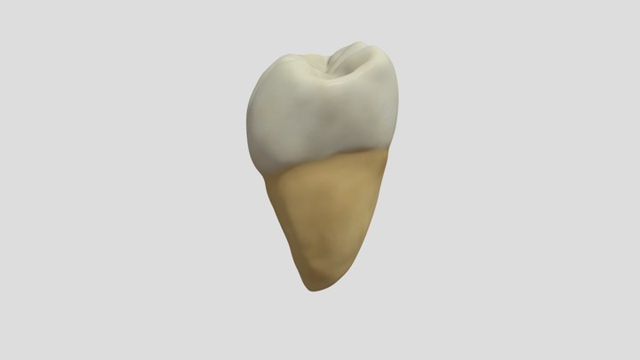 Mandibular Second Molar (Right)