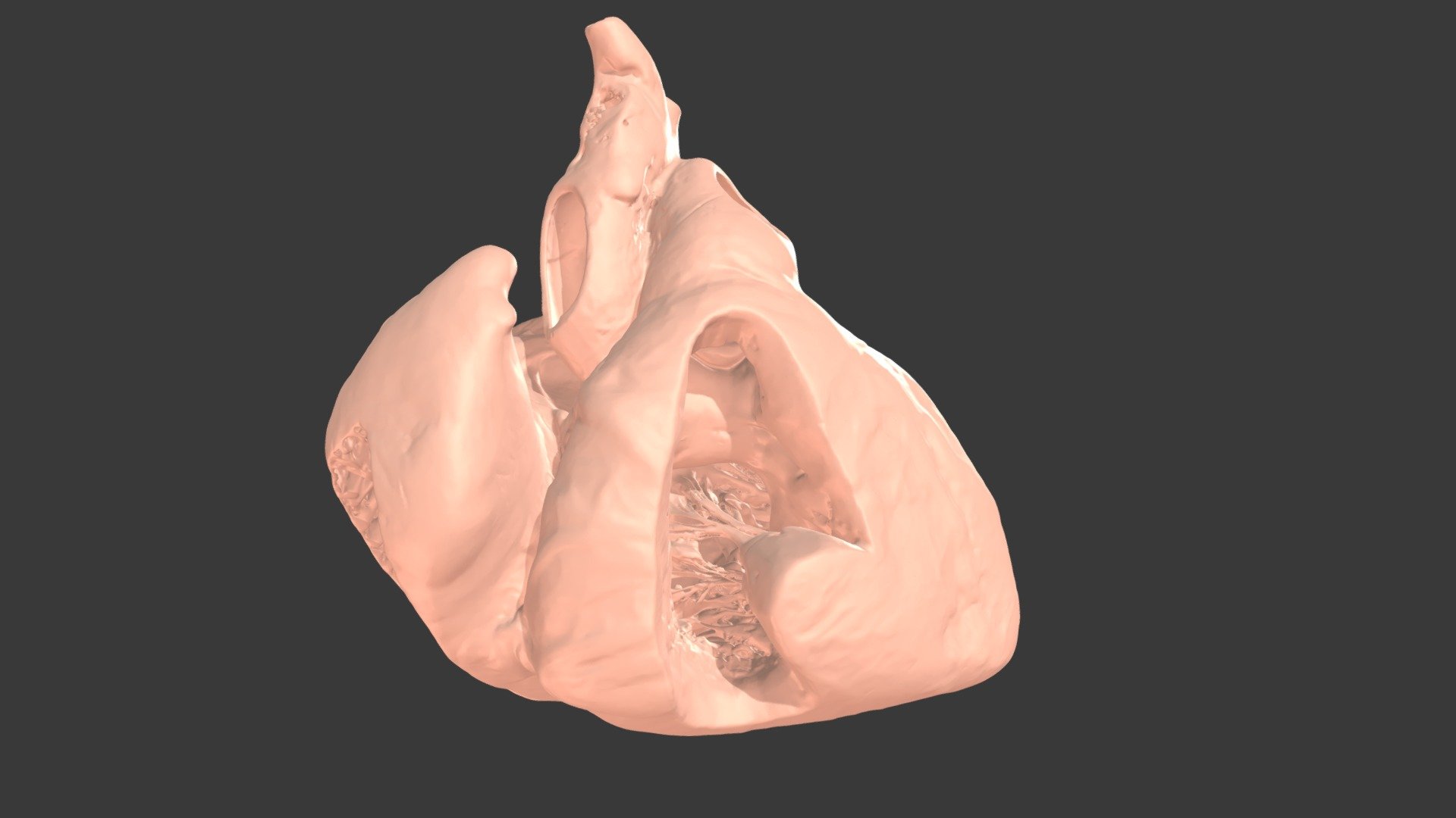 CAVC #2 - {S,D,S} with Complete CAVC (Type C) - 3D model by heartmodels ...