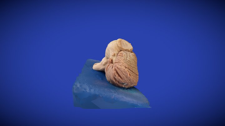 07_02_Tronco encefálico e Cerebelo 3D Model