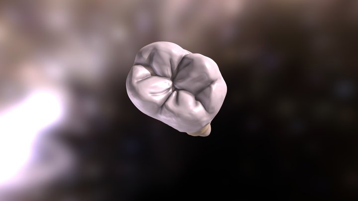 PRIMER MOLAR INFERIOR (46)
