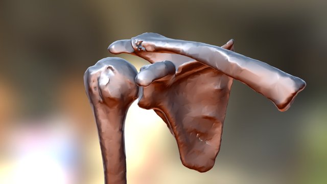 Shoulder Instability02 3D Model