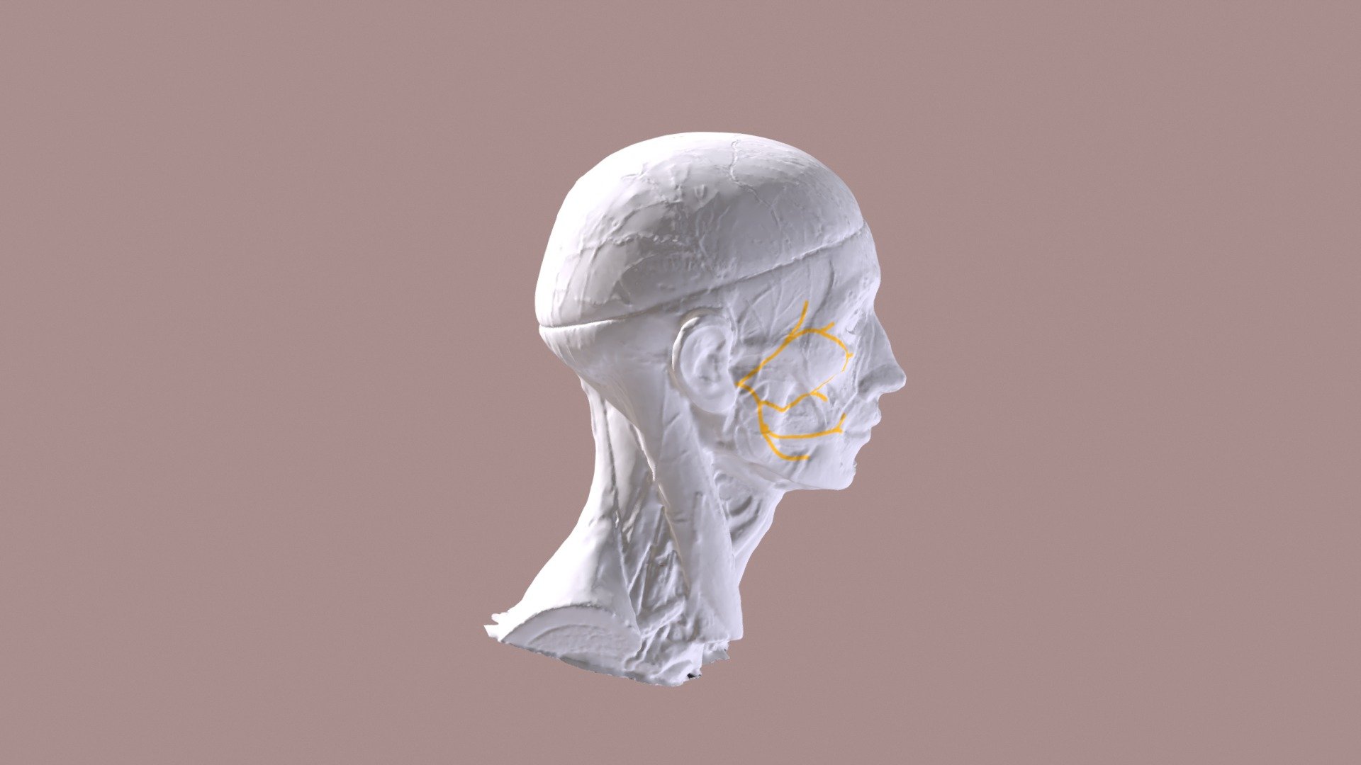 Variation 5