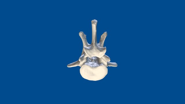 3D Dog Bone Project: L1 vertebra 3D Model
