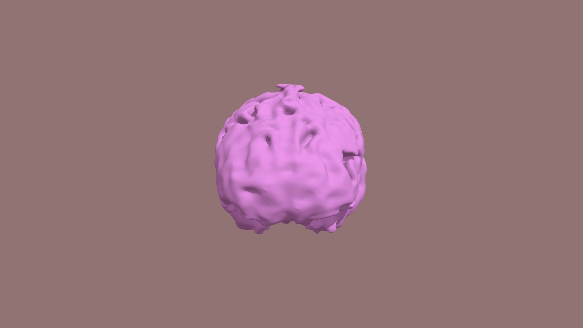 Segmentation Brain