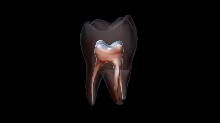 diente75 3D Model