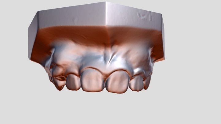 O1maxillary Export 3D Model