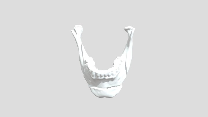 Mandible.stl 3D Model