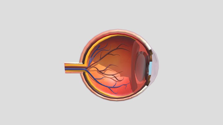 eye_Cataracts 3D Model