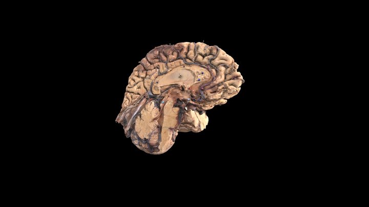 Anterior Cerebral Artery and branches 3D Model
