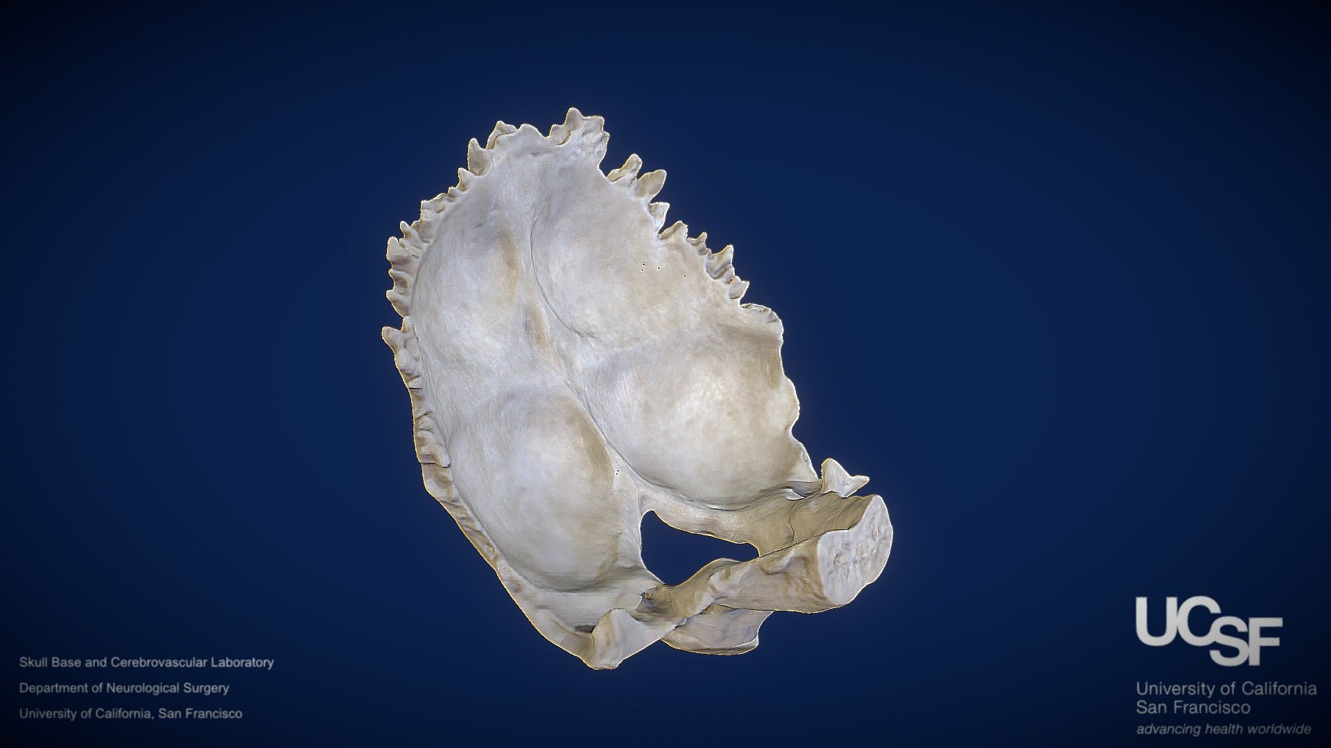 Model 1 Occipital Bone Download Free 3d Model By Sbcvlucsf 1ee6ff7 Sketchfab 3128