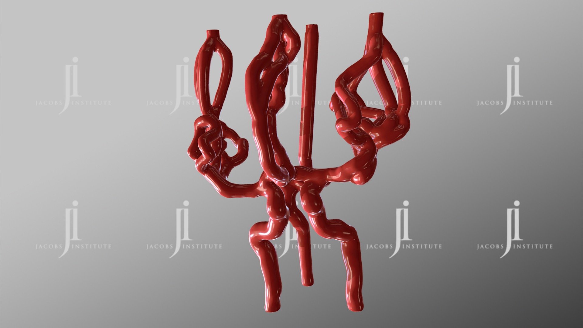 NeuroThrombectomy Model