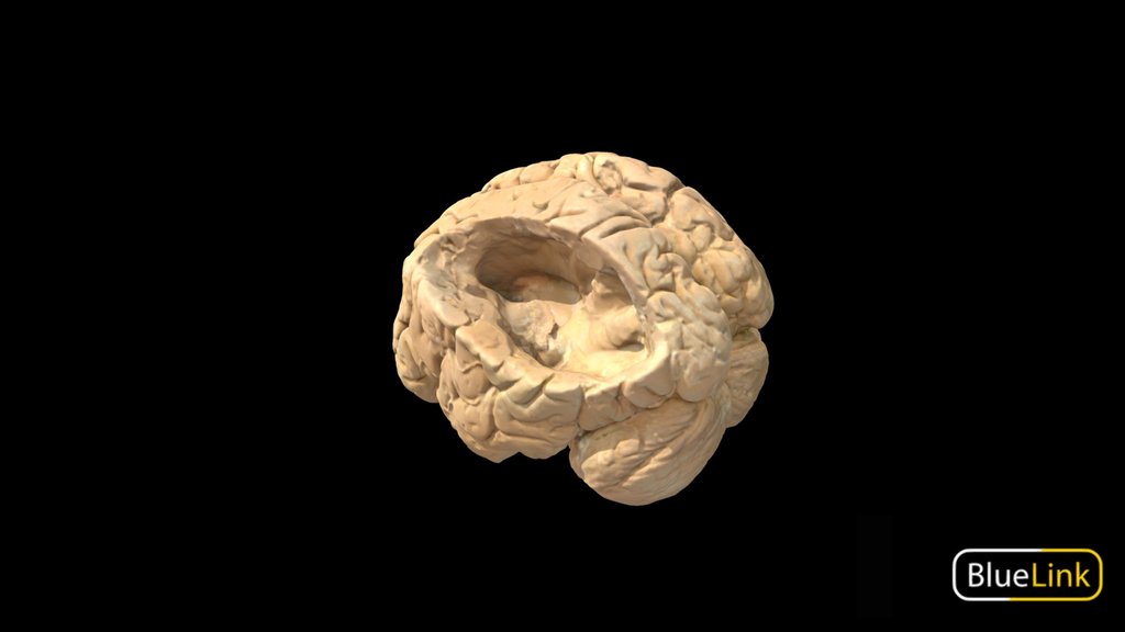 Neuroanatomy - A 3D model collection by UoB_Anatomy - Sketchfab