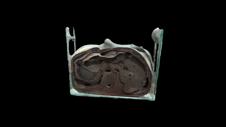 CORTE  AXIAL DE ABDOMEN L2-L3 3D Model