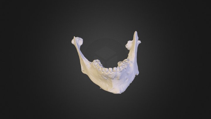 mandibula +intraoral sken +kondylarne chrup. 3D Model