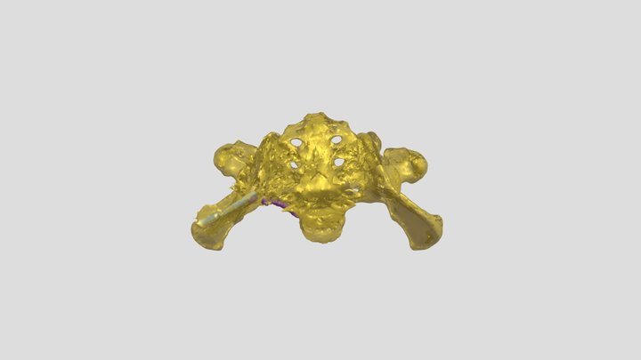 Ramirez_ Segmentation 3D Model