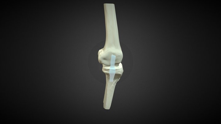 PMMiller BVIS 519 Knee Anatomy Model 3D Model