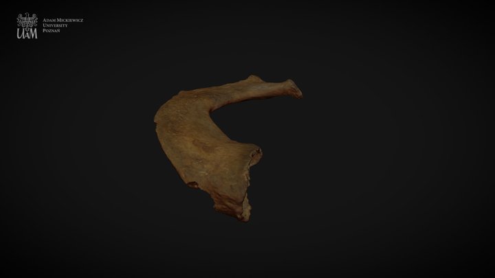 Achondroplastic dwarf  - right R1 3D Model