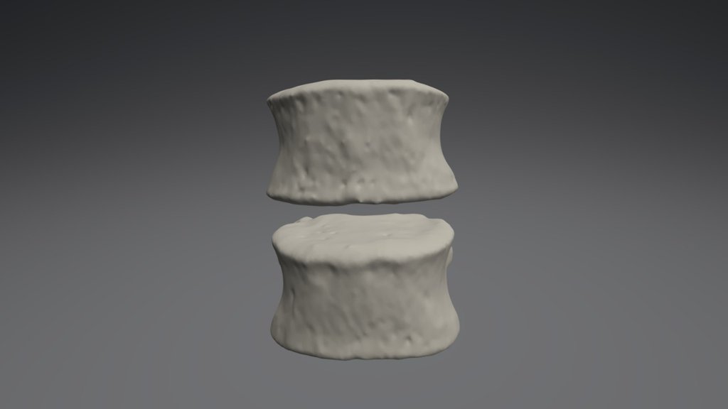 L3-4 Anterior With Dowels