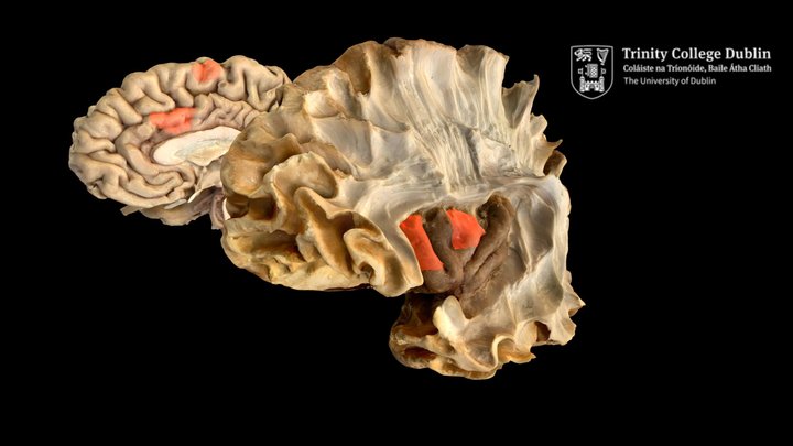 Nodes of the Salience Network 3D Model