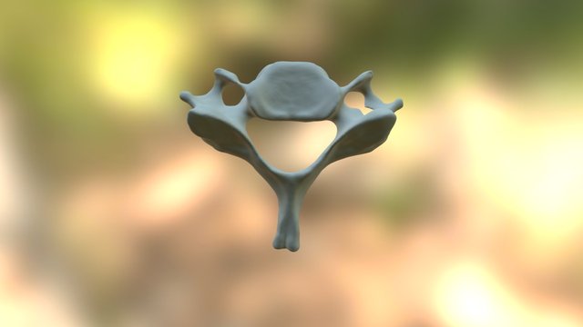 UWF5 Cervical Vertebra 3D Model