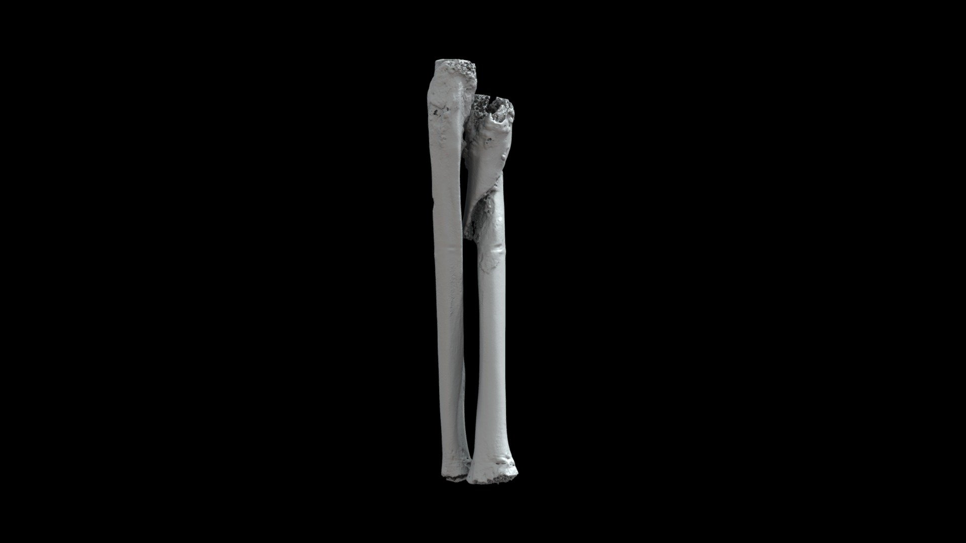 Radius/ulna GSW (VCU_3D_5296) - 3D model by Virtual Curation Lab ...