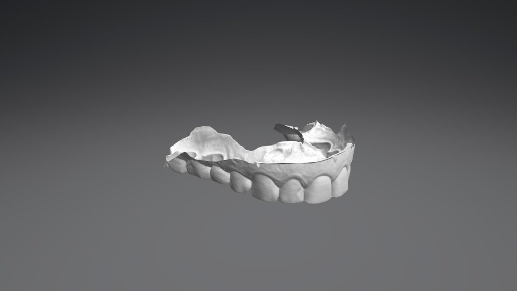 Joao Upper Jaw