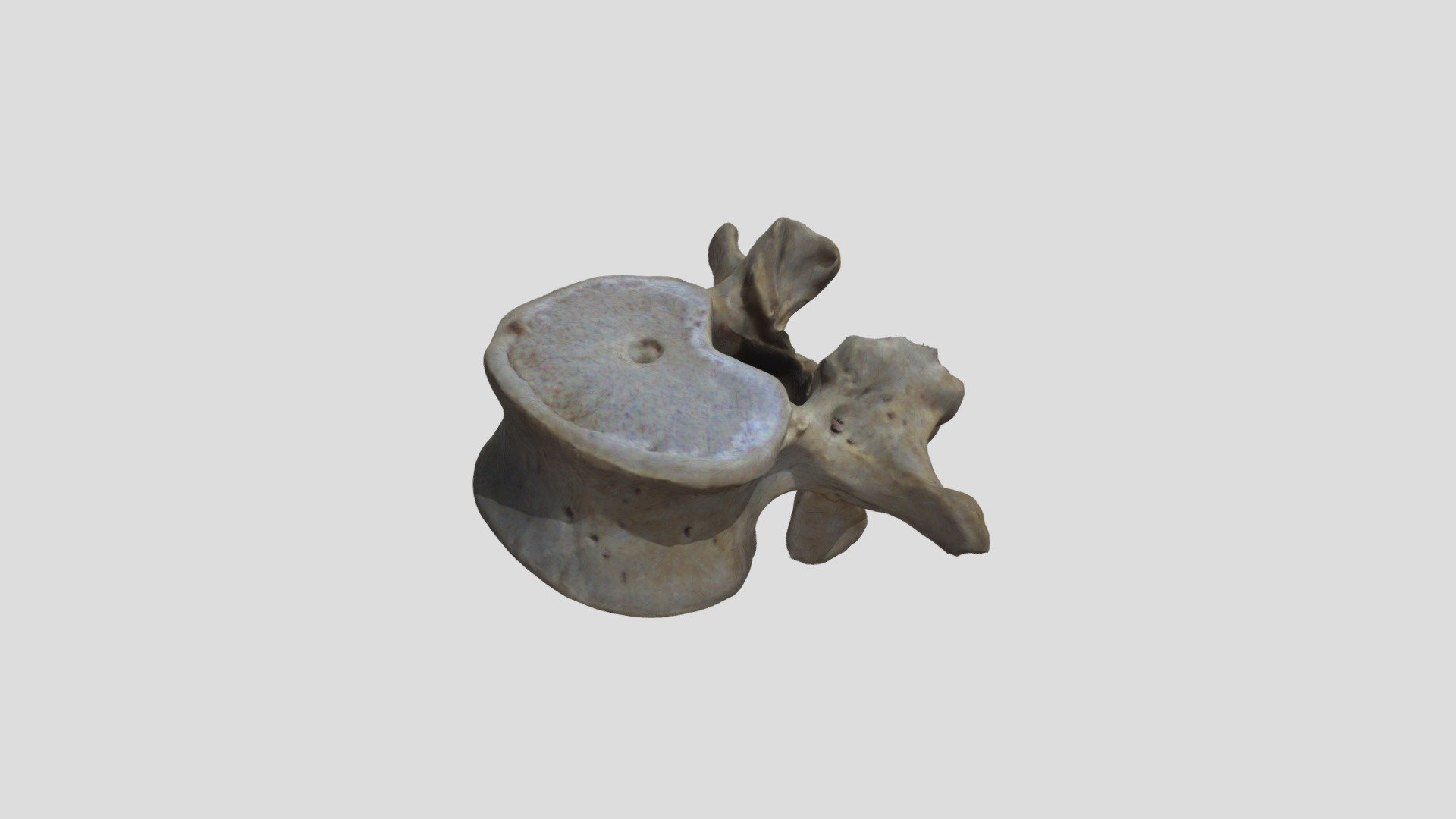 Human - lumbar vertebra ex.