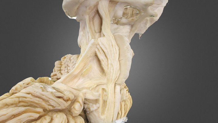 2 3D Model