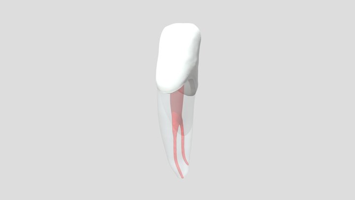 Endodontic #32 3D Model