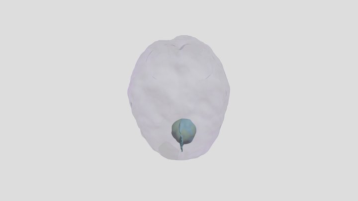 Tumor Modelssegmentation 3D Model