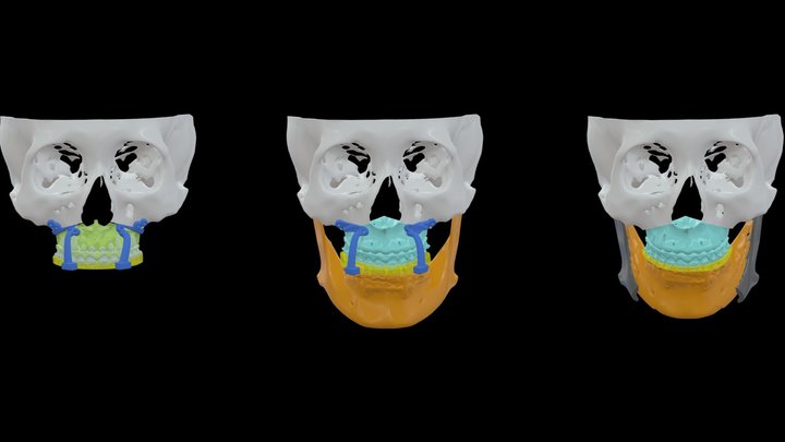 Dr.許-廖O汶-1125 3D Model