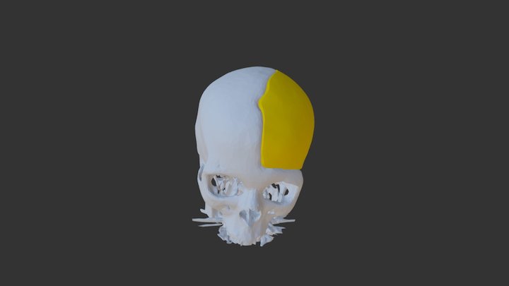 Cranio Implante Small2 3D Model