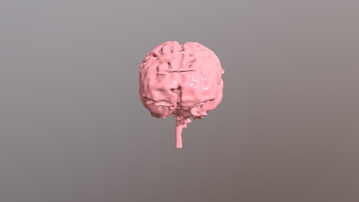 Segmentation Brain 3D Model