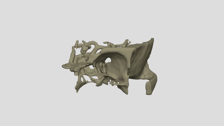 Segmentation_Osso+Aneurisma 3D Model