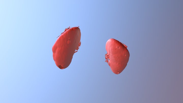 Kidneys 3D Model