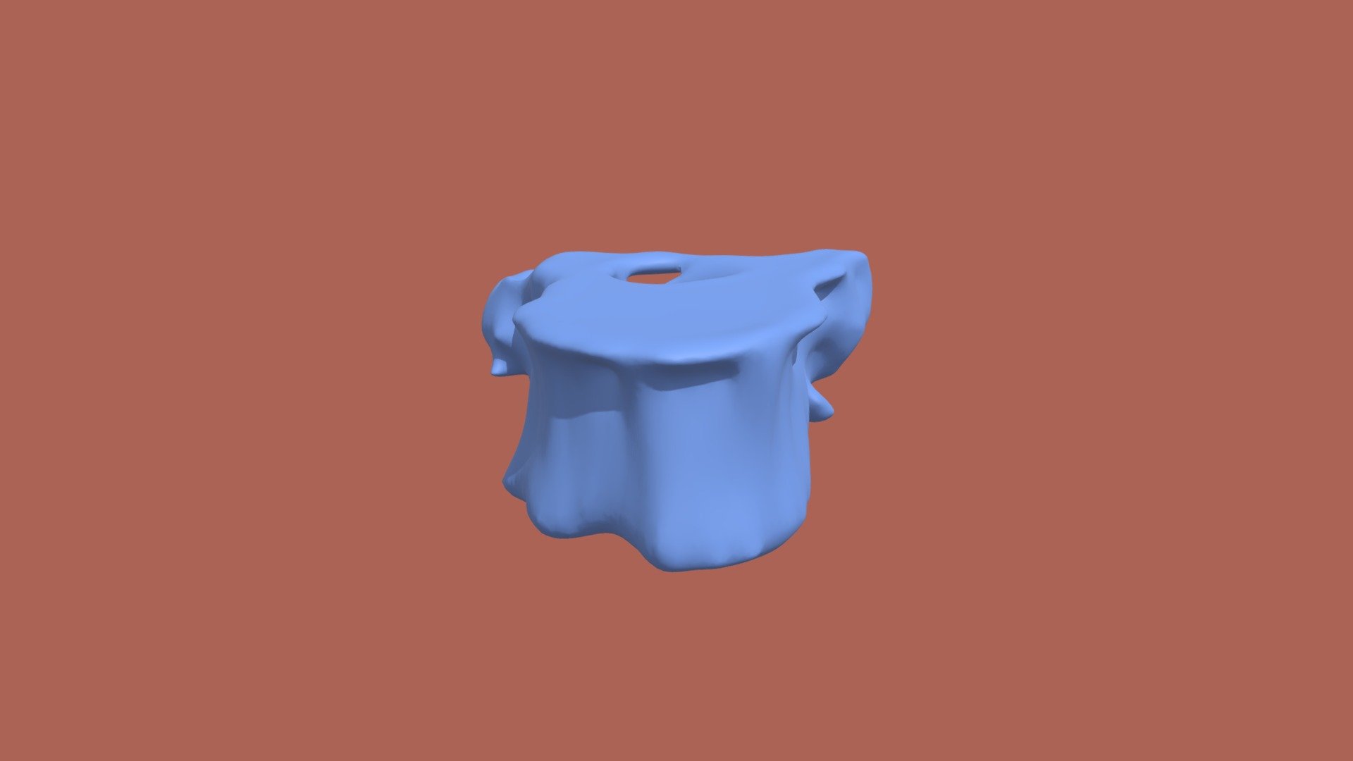 Segmentation_Vertebrae