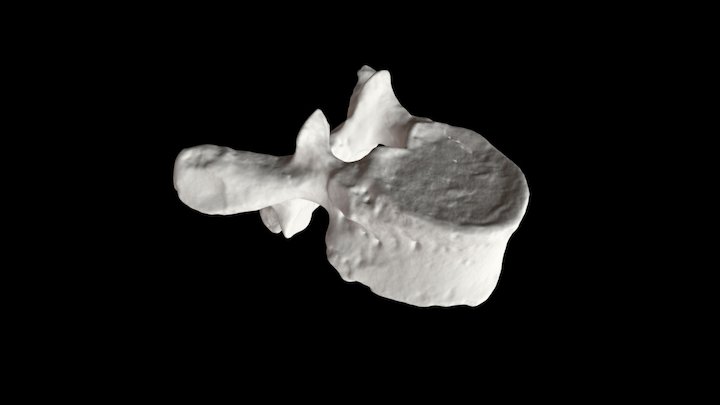 Human Thoracic Vertebra