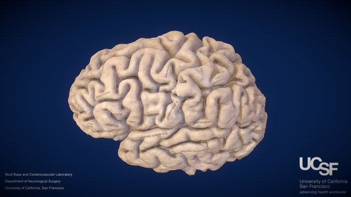 CPs - Model 1: Sulci & Gyri of Left Hemisphere