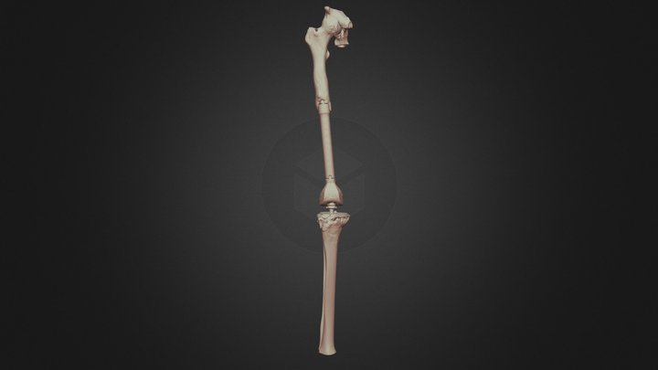 Femoral Prosthesis To Be Revised 3D Model