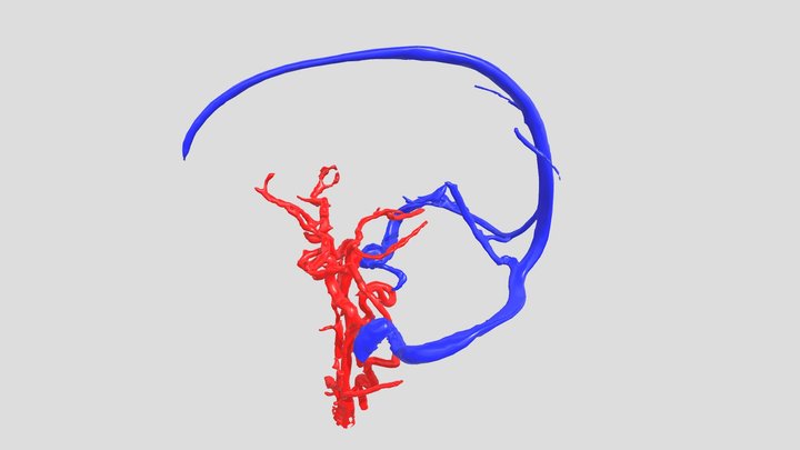Brain Venography 3D Model