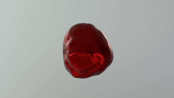 Aneurysm 3D Model