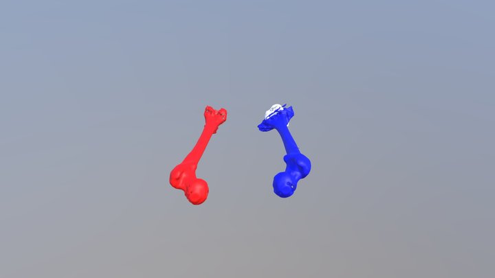Femur Segmentation 3D Model