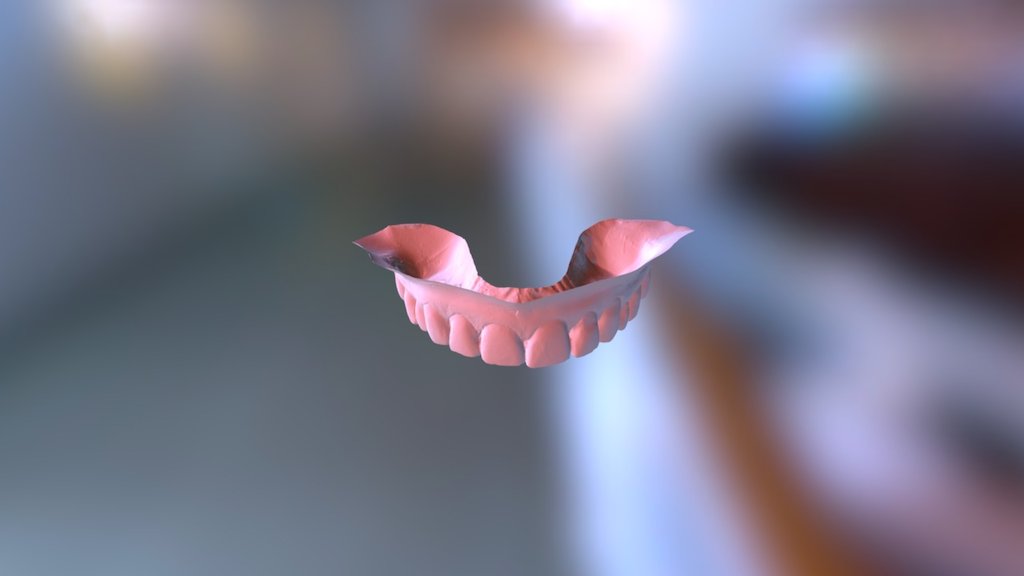Amanda Upper Jaw