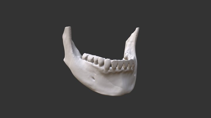 Jaw with preserved nerve tubes 3D Model