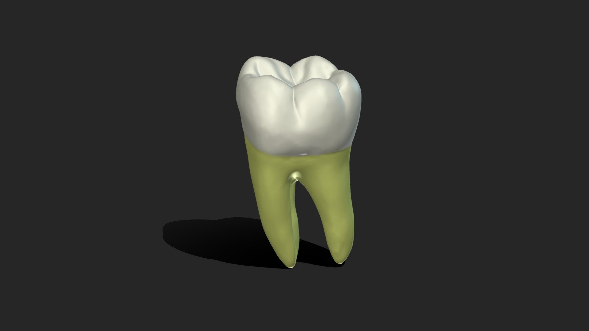 Mandibular 3rd Molar Animated