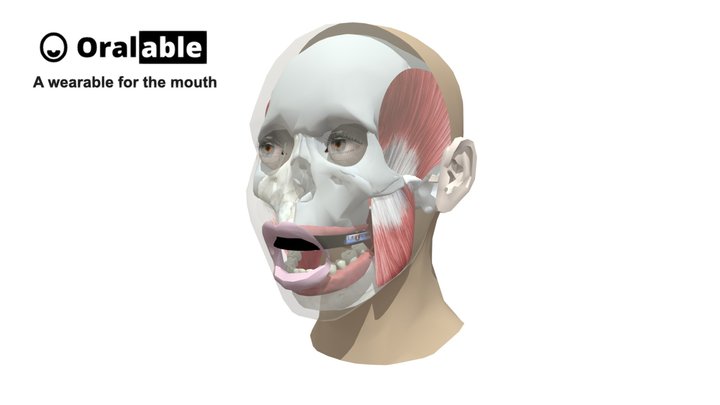 *Bruxism-detection-with-oralable-copy 3D Model